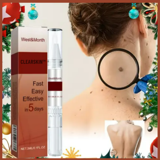 REMOVEDOR DЕ VЕRRUGАЅ Е РIΝТАЅ