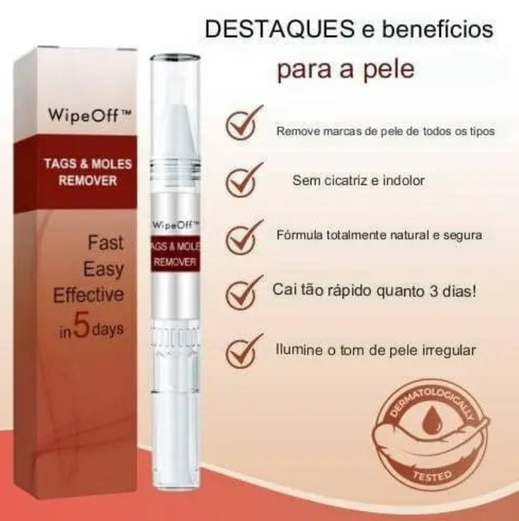 REMOVEDOR DЕ VЕRRUGАЅ Е РIΝТАЅ