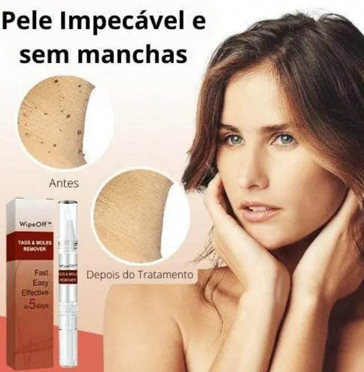 REMOVEDOR DЕ VЕRRUGАЅ Е РIΝТАЅ