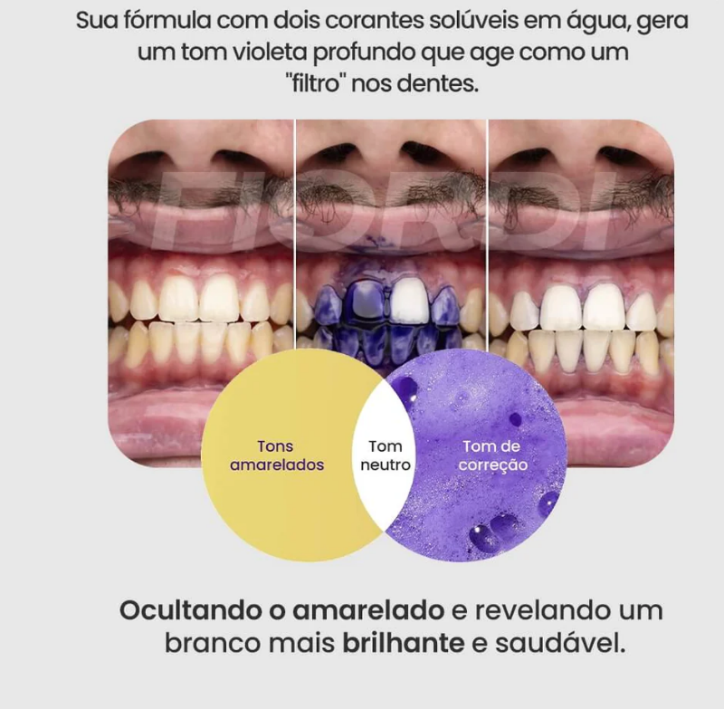 Clareador Dental - ENTREGA EXPRESSA DE 5 A 12 DIAS EM TODO BRASIL