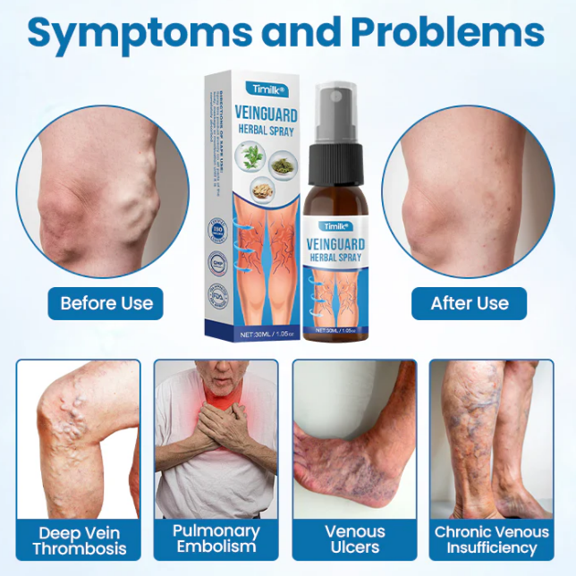 Spray VeinGuard