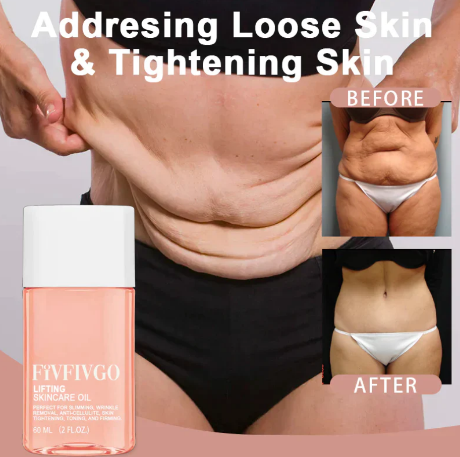 Exterminador de Medidas