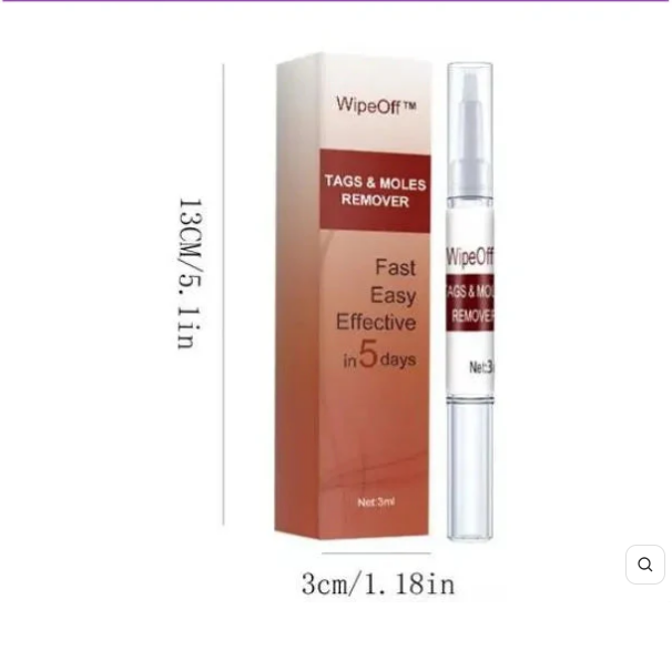 REMOVEDOR DЕ VЕRRUGАЅ Е РIΝТАЅ