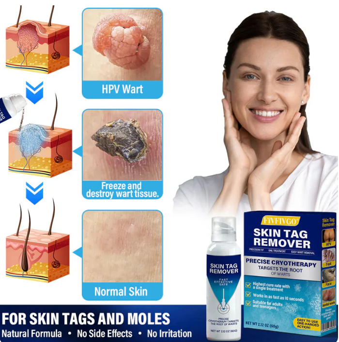 Spray de tratamento VERRUGAS E PINTAS