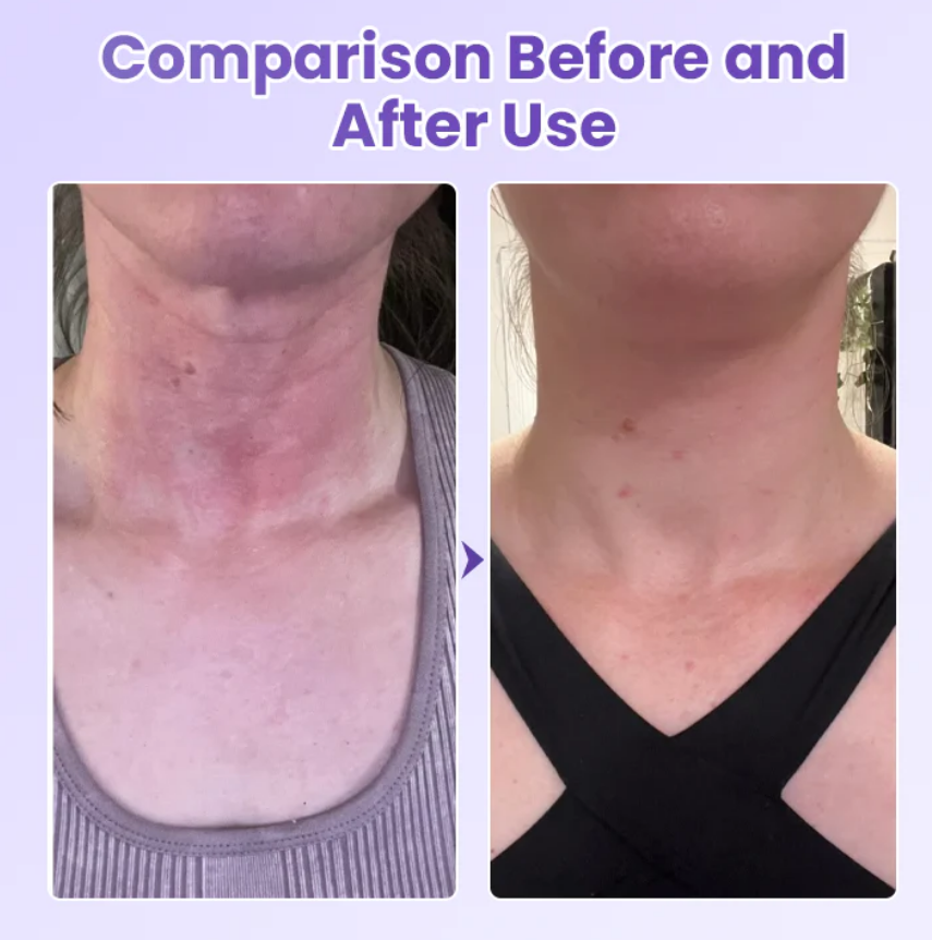 Neckyouth - PESCOÇO LISO