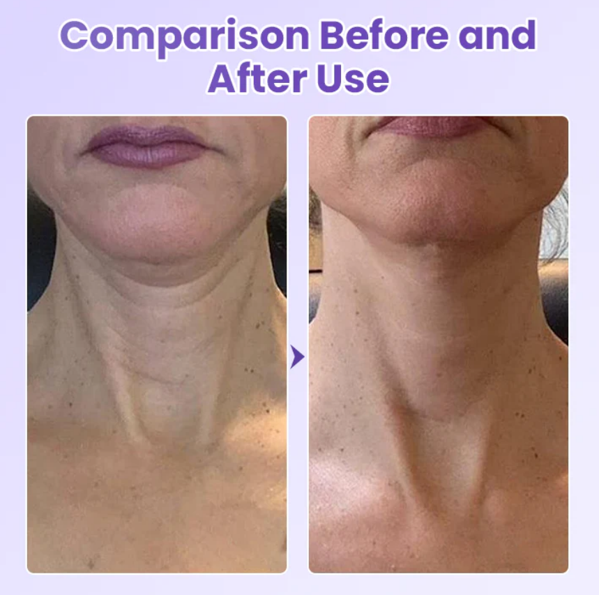 Neckyouth - PESCOÇO LISO