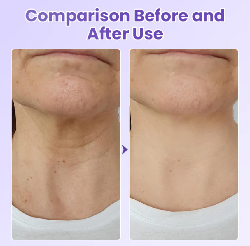 Neckyouth - PESCOÇO LISO