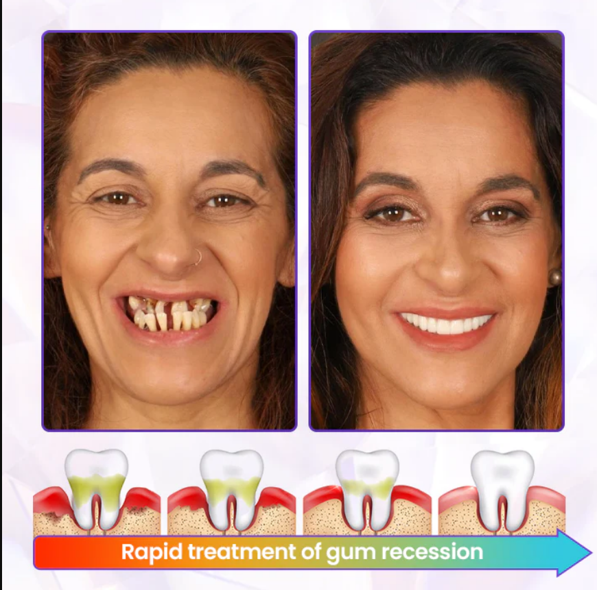 BeeRenew Advanced Gum Healing