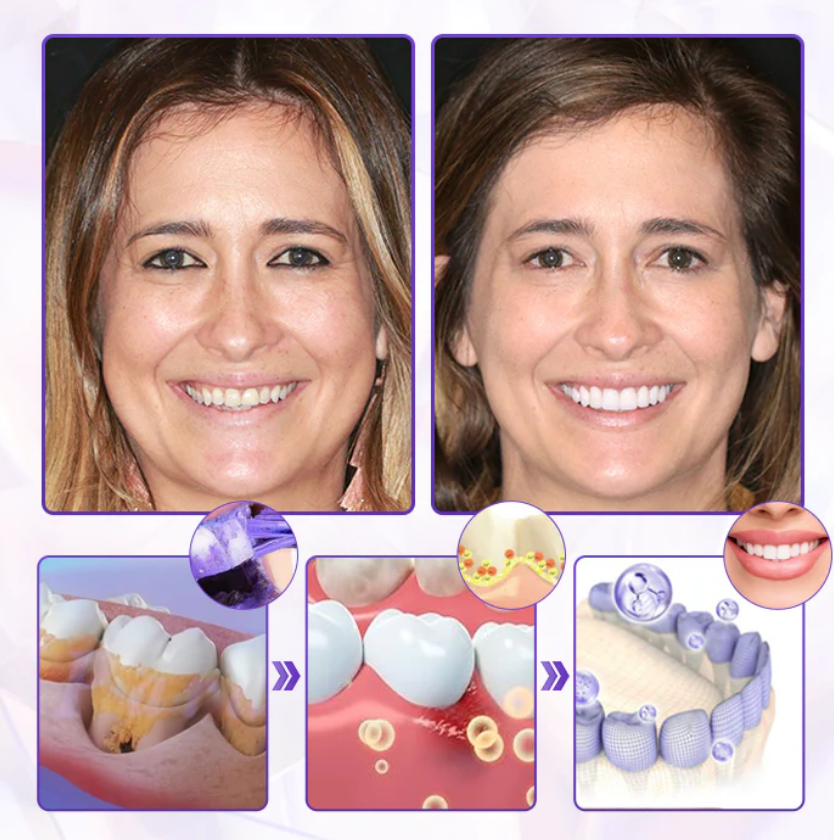 BeeRenew Advanced Gum Healing