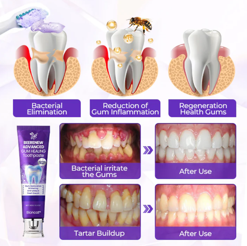 BeeRenew Advanced Gum Healing